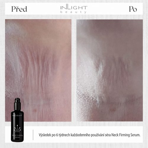 Inlight Bio zpevňující sérum na krk