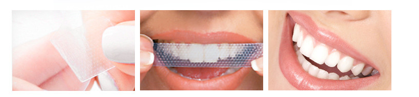 Krasaprozeny.cz - Domácí bělení zubů- originál bělící pásky Bright White  Professional - 28ks kúra na 14dnů - Bělení zubů - ZDRAVÍ, KRÁSA