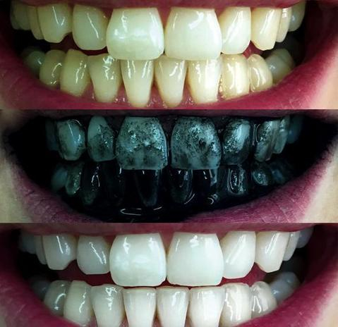 Krasaprozeny.cz - Aktivní bělící pudr na zuby DAZZLING WHITE - NOVINKA! -  Bělení zubů - ZDRAVÍ, KRÁSA
