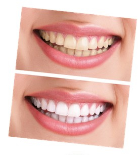 Krasaprozeny.cz - Bělící zubní pasta Crest 3D White Glamorous White - Akční  cena - Bělení zubů - ZDRAVÍ, KRÁSA