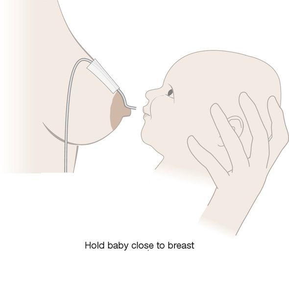MEDELA DOPLŇKOVÝ SYSTÉM KE KOJENÍ SUPLEMENTOR - NÁHRADNÍ DÍLY K ODSÁVAČKÁM - KRMENÍ