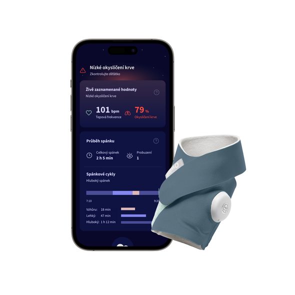 OWLET DREAM SOCKTM – CHYTRÁ PONOŽKA 0-18 MĚSÍCŮ - MONITORY DECHU - SPINKÁNÍ