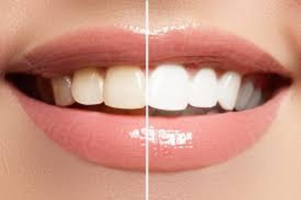 VIPhair.cz - Bělící zubní pasta Crest Tartar Protection - Bělení zubů -  ZDRAVÍ A KRÁSA