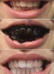 Bělící zubní pasta Splat Special Blackwood