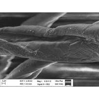 Nanosilver materiál pod mikroskopem!