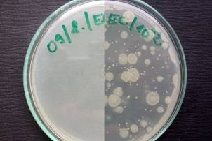 Stříbro je stále nejlepší materiál proti bakteriím