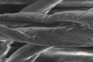 Nanosilver materiál pod mikroskopem!