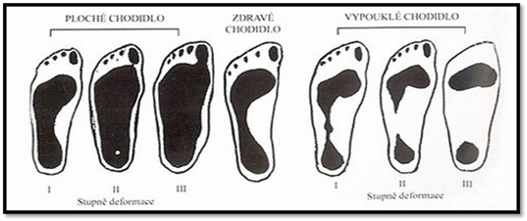 Jak vybrat boty na široká a oteklá chodidla