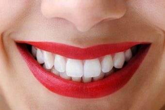 Jak si vybělit zuby doma - pokud možno: snadno, rychle a levně.