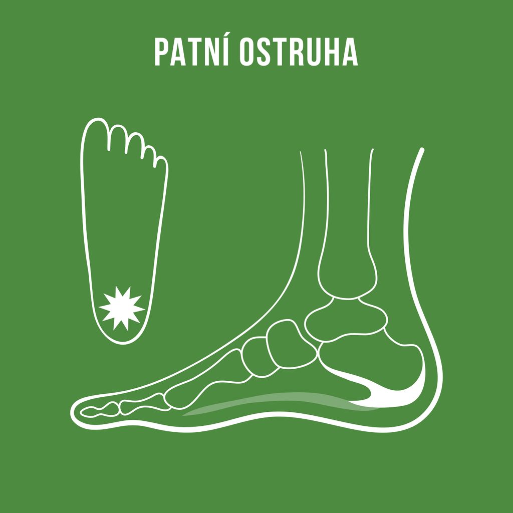 naBOSo – Patní ostruha: symptomy i tipy, jak se jí úspěšně zbavit – Zažijte  pohodlí barefoot bot.
