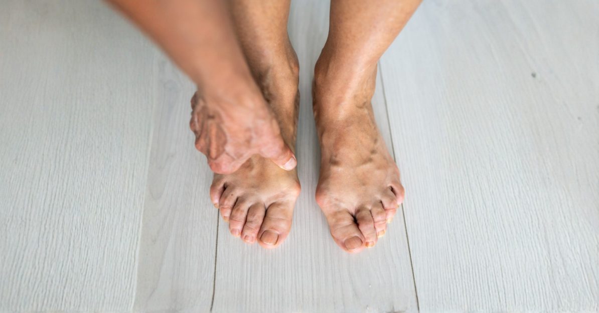 4/4 Vbočené palce pod kontrolou: Nejlepší metody prevence a léčby halluxů