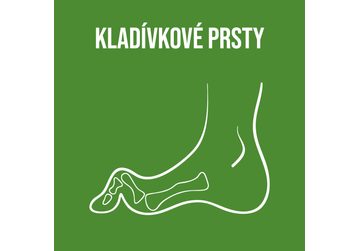 Kladívkové prsty: Když nohy volají o pomoc – příčiny, prevence i řešení