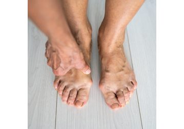 4/4 Vbočené palce pod kontrolou: Nejlepší metody prevence a léčby halluxů