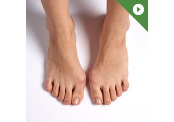 PODCAST: Bc. Edita Prošková: Vbočený palec pod lupou: Co způsobuje hallux valgus a jak mu předcházet?