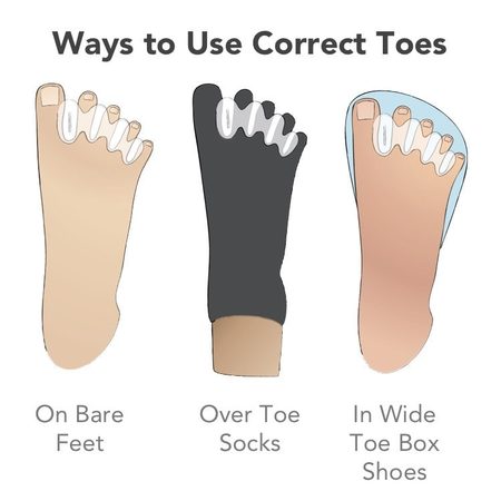 CORRECT TOES