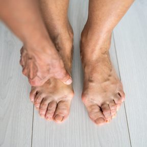 4/4 Vbočené palce pod kontrolou: Nejlepší metody prevence a léčby halluxů