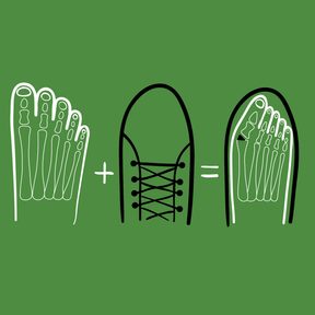 2/4 Hallux valgus? Správná obuv vám může změnit život. Zjistěte, jak ji vybrat