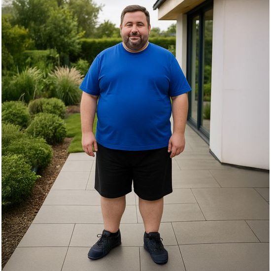 NADROZMERNÉ ŠORTKY UNISEX - ŠORTKY - OBLEČENIE