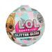 L.O.L. Surprise Glitter Globe Asst in PDQ