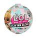 L.O.L. Surprise Glitter Globe Asst in PDQ