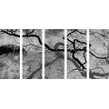 5-DELNA SLIKA NADREALISTIČNA DREVESA V ČRNOBELI VARIANTI - ČRNOBELE SLIKE - SLIKE