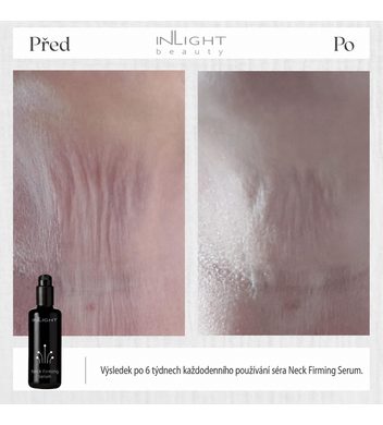 Aloés Microbiota obnovující hydratační sérum