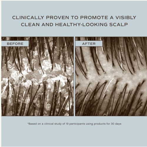 INNERSENSE Hair Renew Soothing Conditioner - Zklidňující kondicionér na vlasovou pokožku