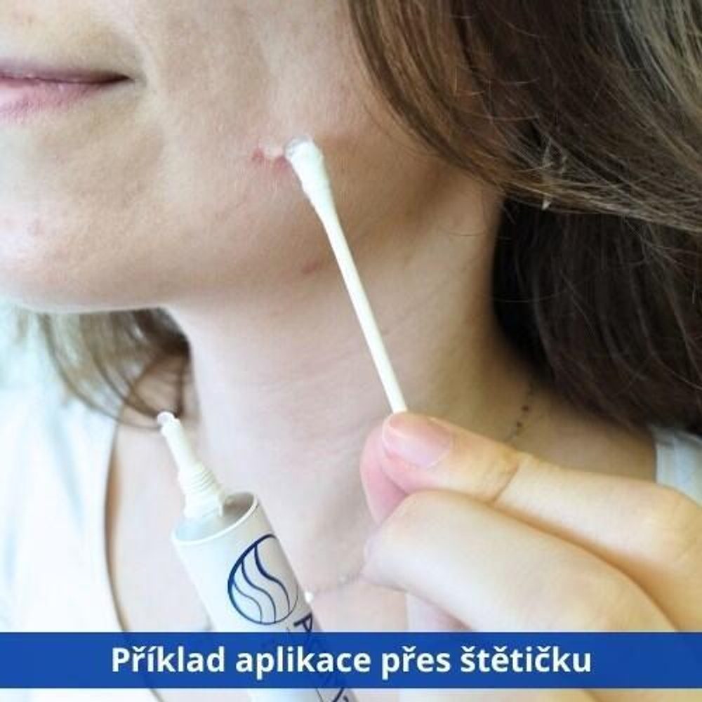 ActiMaris Gel 20 g pro rychlé hojení (obrázek 3)