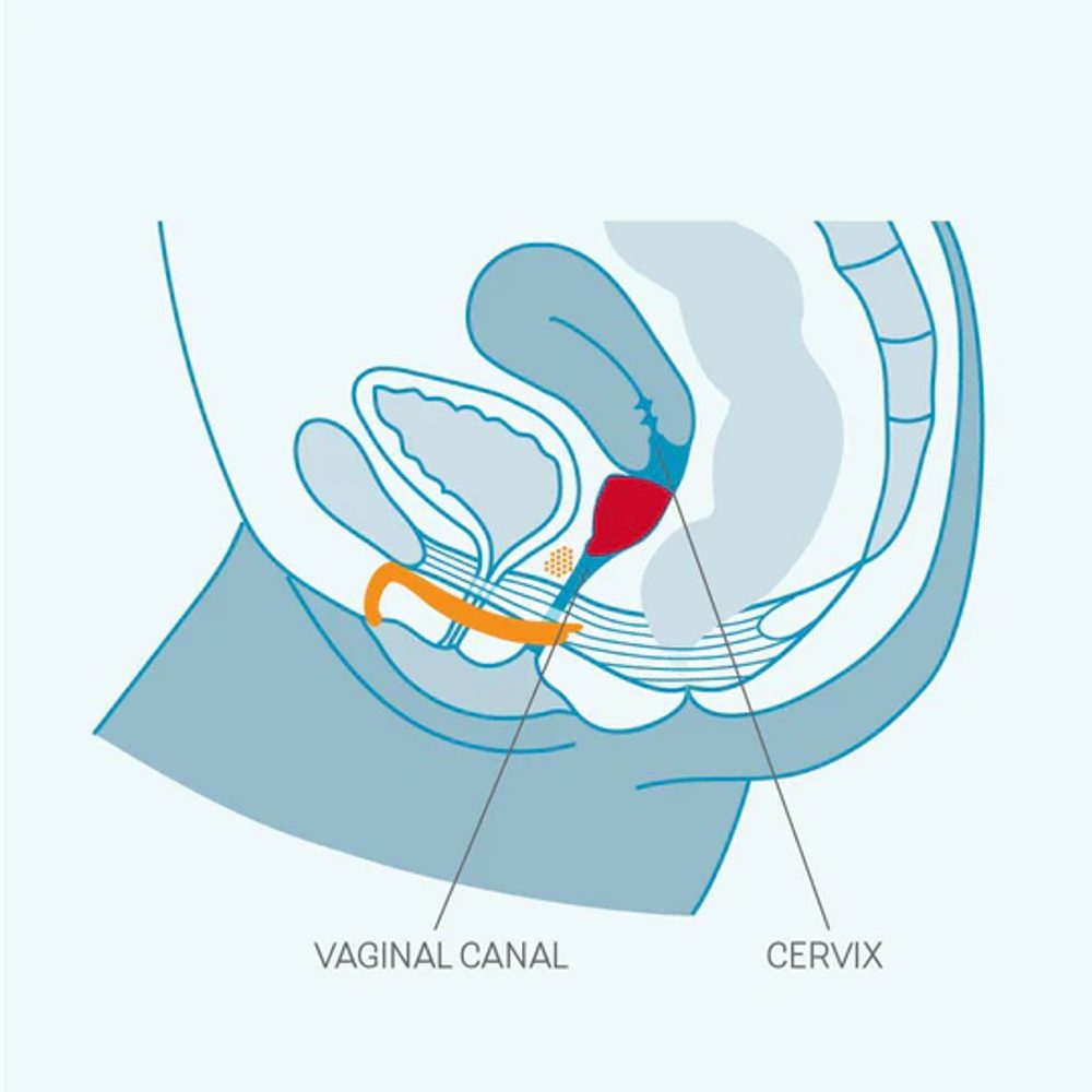 Fun Cup Menstruační kalíšek A - Obrázek 6