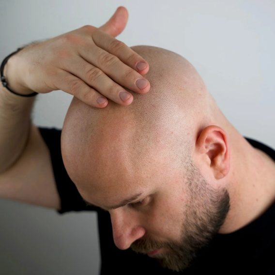 Better Be Bold — Magic Bald Head & Beard Oil