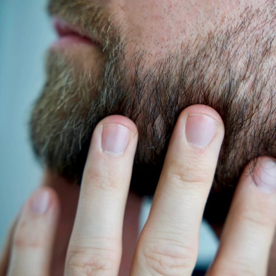 Better Be Bold — Magic Bald Head & Beard Oil