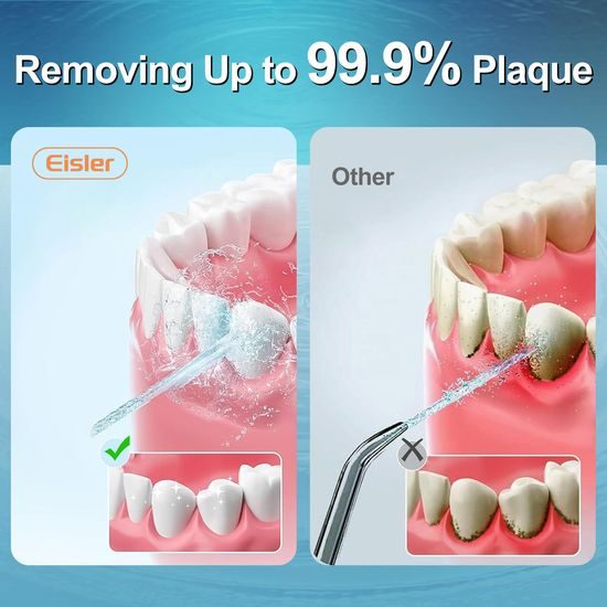 Bezprzewodowy irygator dentystyczny z zestawem końcówek, 4 tryby, zbiornik 300 ml, USB-C, biały