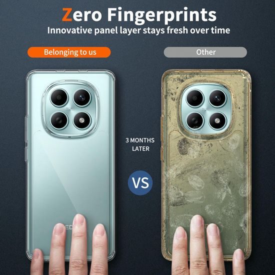 JP Prozirna maska, Xiaomi Redmi Note 15 4G