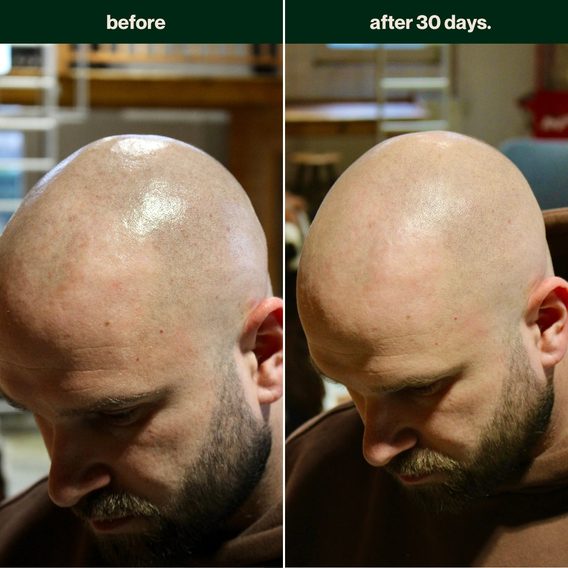 Mattierende Glatzencreme BETTER BE BOLD No Hair. Full Care. Bald Cream (50 ml)