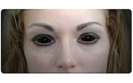 Crazy šošovky - nedioptrické - BLACK mini sclera (2 šošovky)