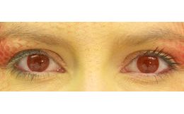 RED DEAD Lentilles de Couleur