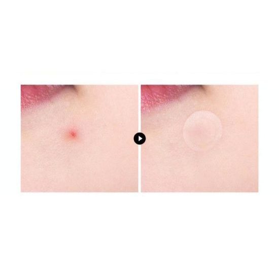 VT COSMETICS Náplasti na akné Pro Cica Centella Asiatica Tiger Clear Spot Patch (66 ks)