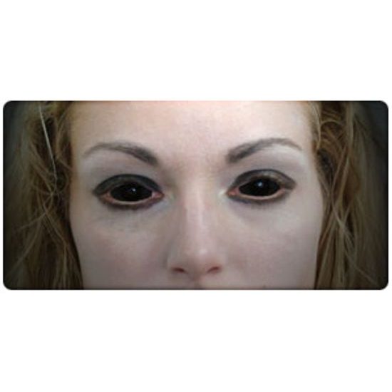 BLACK SCLERA barvne leče
