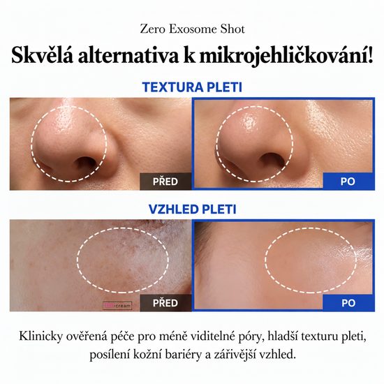 MEDICUBE Pleťové sérum Exosome Shot Pore Ampoule 2000 (30 ml)