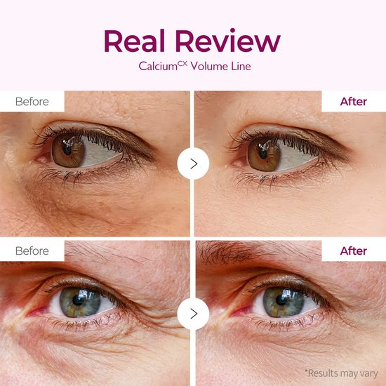 Dr. MELAXIN Hydrogelové polštářky Ceramide Calcium Volume Eye Patch (60 ks)