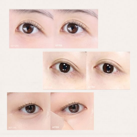 MARSHIQUE Augenmasken Wrinkle Repair Hydrogel Eye Patch