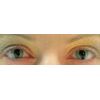 ALIAN Contact Lenses