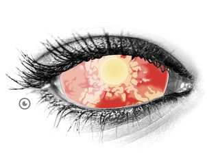 Blind Contacts: Elevate Your Look with Unique and Eerie Lenses