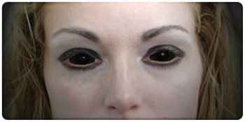 BLACK SCLERA Contact Lenses - Lucifer - Sclera Contacts - SCLERA-LENSES