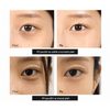 DR. MELAXIN Calcium Dark Spot Cover Eye Cream (15 g)