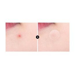 VT Náplasti na akné Pro Cica Centella Asiatica Tiger Clear Spot Patch (66 ks)