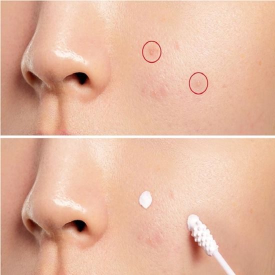 Cosrx AC Collection Blemish Spot Drying Lotion (30 ml)