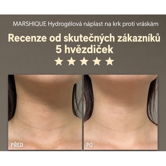 MARSHIQUE Hydrogelové náplasti na krk Wrinkle Repair Hydrogel Neck Patch