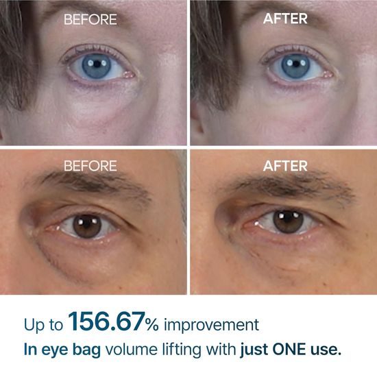 Dr. MELAXIN Oční krém Eyephalt Eyecream for Eyebags (10 ml)