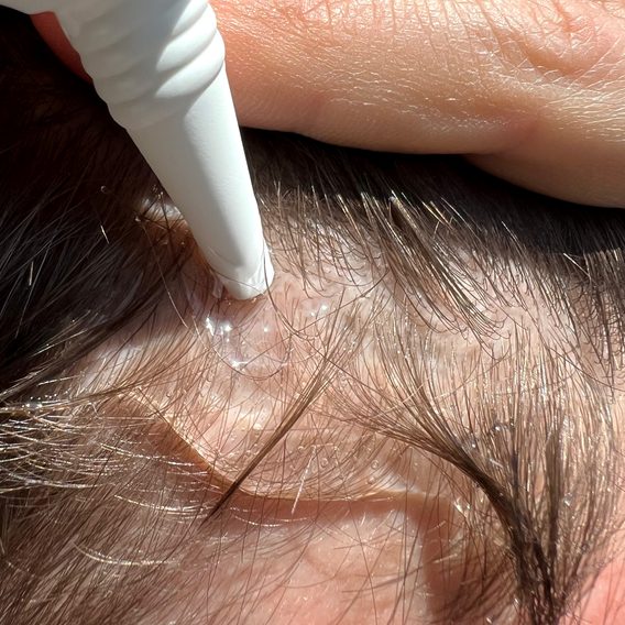 Copenhagen Grooming — Hair Growth Activator (100 ml)